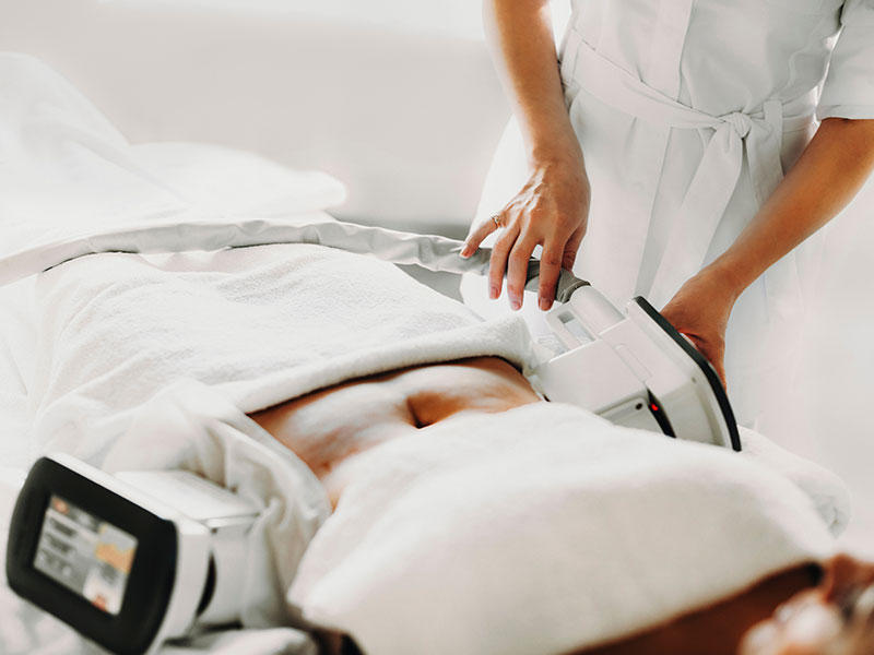 cryolipolysis gallery 03