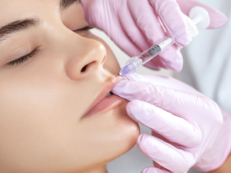 dermal fillers level 1 gallery 04