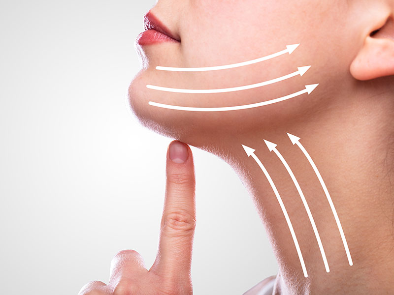 laser skin tightening gallery 02