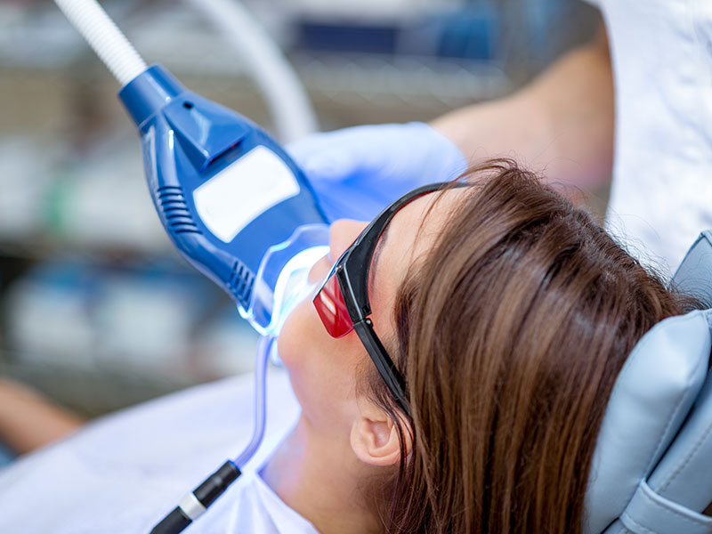 laser teeth whitening gallery 04