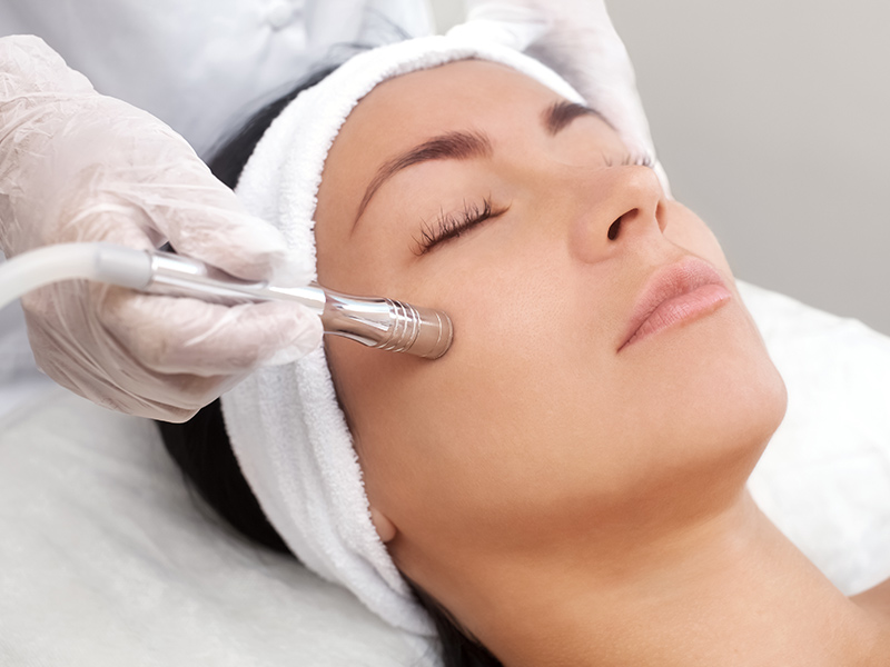 microdermabrasion gallery 01