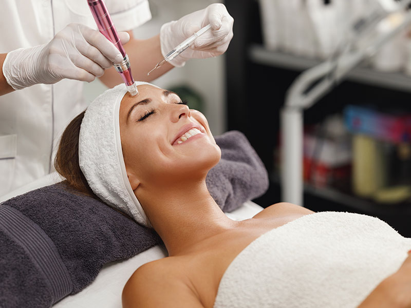 microneedling gallery 03