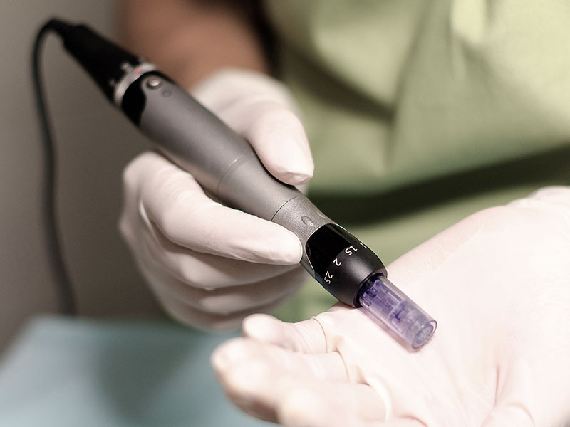 microneedling gallery 04